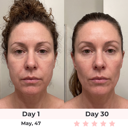Glowelin 7-in-1 LED Facial Sculptor