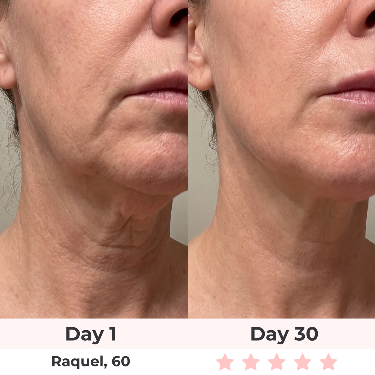 Glowelin 7-in-1 LED Facial Sculptor