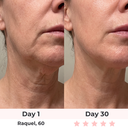 Glowelin 7-in-1 LED Facial Sculptor