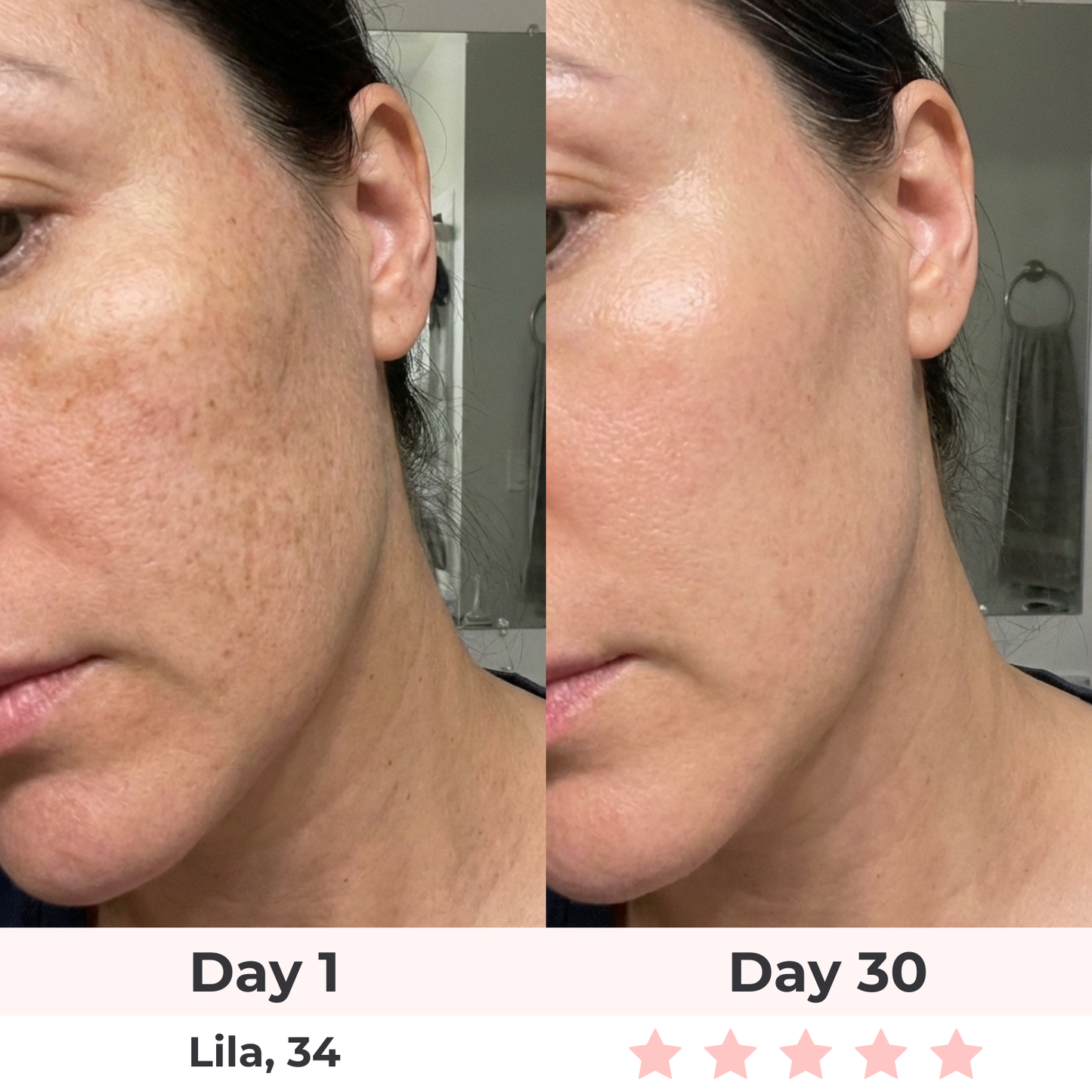 Glowelin 7-in-1 LED Facial Sculptor
