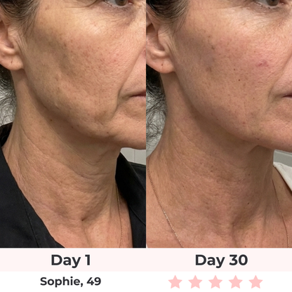 Glowelin 7-in-1 LED Facial Sculptor
