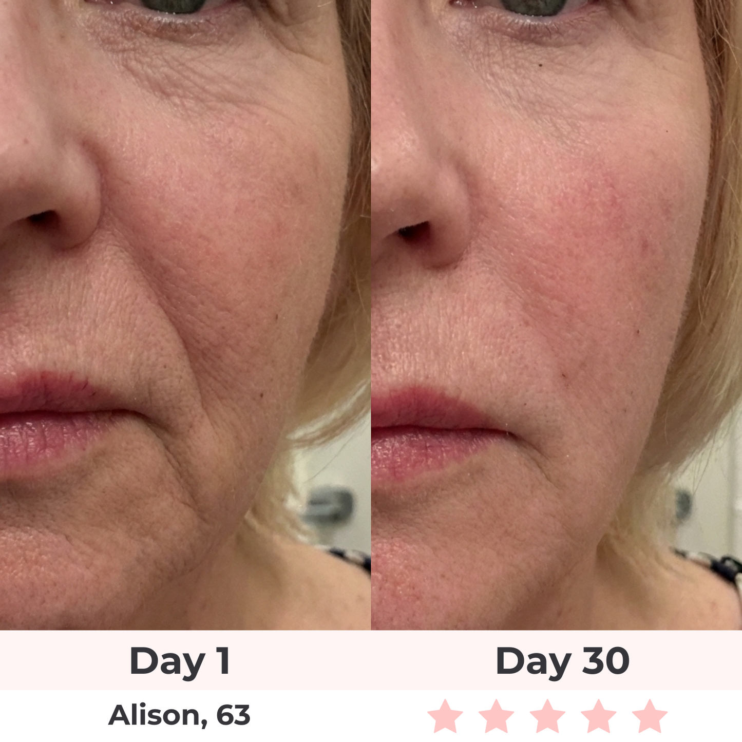 Glowelin 7-in-1 LED Facial Sculptor
